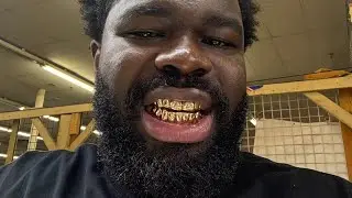 day 3 in Atlanta i got my grillz lol &hellip;