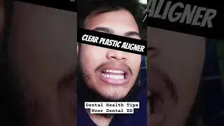Removal Retainer @DentalHealthTips