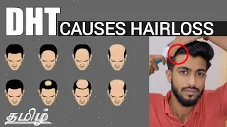 How To Block DHT | Reverse HAIR LOSS | Regrow HAIR | Tamil
