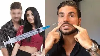 K&eacute;vin #MELAA5 Ses Chirurgies-Esth&eacute;tiques ? Il compte et d&eacute;voile tout !