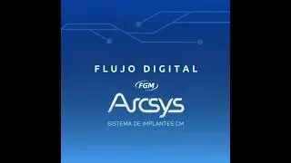 Restauraci&oacute;n sobre Coping Friccional Arcsys sin cemento - Arcsys