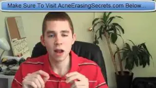 Baking Soda For Acne And Pimple Treatment