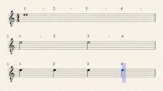 Music Note Tree Exercise