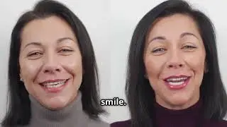 Dental Veneers 101: Fix Gaps, Chips & Stains Without Looking Fake!