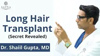 Long Hair Transplant | Hair Transplant results | Satya Clinic | Dr Shaiil