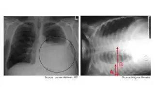 X ray review Principles for Usmle Step 1
