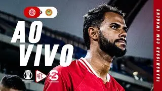 [🔴AO VIVO ] AMÉRICA X JUAZEIRENSE-BA | CAMPEONATO BRASILEIRO | 10/08/2025