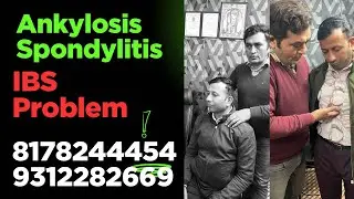 ANKYLOSIS SPONDYLITIS AND IBS KI PROBLEM 100% Theek