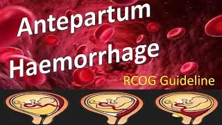 Abruptio placenta انفصال المشيمه