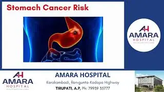 Stomach Cancer risk factors | Amara Hospital, Tirupati