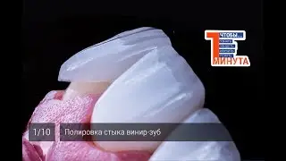 Полировка стыка винир-зуб