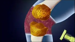 Collagen 4LIFE