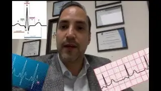 Descifrando el Electrocardiograma