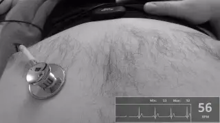 Heartbeat stream ...