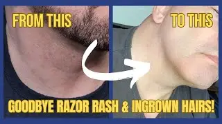 Say Goodbye to Razor Burn: Best Post Shave Products Revealed