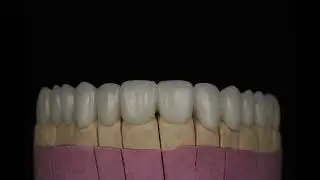 Metal ceramic..metalkeramika…металкерамика