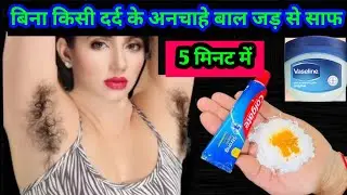 Permanent hair removal at home | Best Hair Removal Cream | Painless hair removal | DIY Remedies
