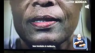 S&Oacute; A NOVA PARAB&Oacute;LICA SKY B1 TE D&Aacute; DIREITO A TER A REGIONAL DA GLOBO DA SUA LOCALIDADE comJo&atilde;o Pedro 