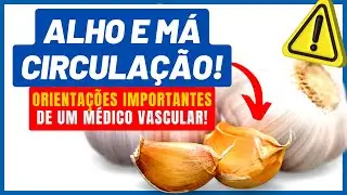 ALHO E MÁ CIRCULAÇÃO - informações IMPORTANTES! Dr. Alex Vascular