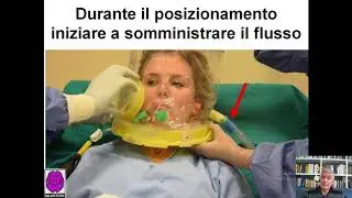 Cosa sapere e fare quando posiziono un casco da CPAP parte3