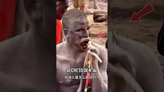 &iexcl;Impresionante! As&iacute; se lavan los dientes en &Aacute;frica