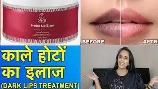 Dark Lips Treatment | How to get Pink Lips with 7Days Lip Balm | Lighten up your Dark Lips Naturally