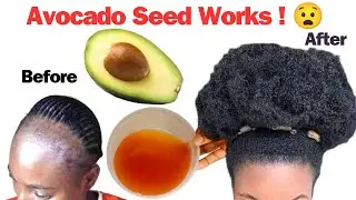 IT WORKS! DON'T IGNORE IT. How to Make Avocado Seed Treatment For Fast Hair Growth