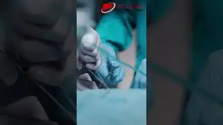Liver Transplant क्या है और कब जरूरी?💡Liver Transplantation | Dr. A.S Soin