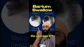 Live Swallowing X-rays | Fluoroscopy