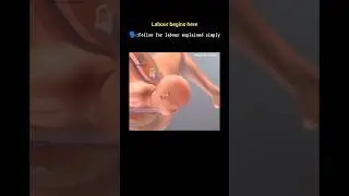 Cervical Dilation in 1st Stage of Labour | Explained Simply #youtubeshorts