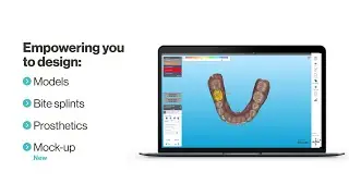 Single-visit dentistry made simple with iTero&trade; Design Suite | 2025 Update