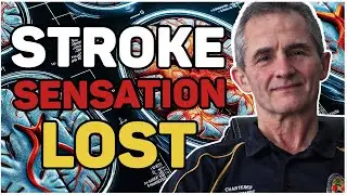Stroke: Sensation Lost