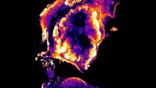 Visikol HISTO - Mammary Tissue - Ki67