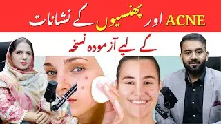 Acne & Pimples Marks Ka Asaan Natural Ilaj | Naima Apa | Think Digital Podcast