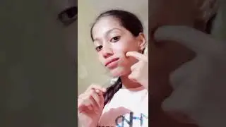 Tik Tok viral fake dimple hack with bottle cap!! 🙀🤯 would you try this!!?? #viral #trending