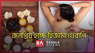 জনপ্রিয় হচ্ছে হিজামা থেরাপি | BA News | Cupping Therapy | Akash Islam