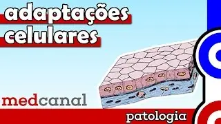 Adaptações Celulares | PATOLOGIA