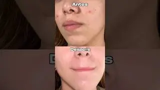 345 Dr althea 🌞 #dralthea #cremahidratante #skincarecoreano #cuidadodelapiel #cuidadofacial