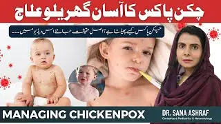 Chickenpox in Children – Symptoms, Causes & Easy Home Treatment | Dr. Sana Ashraf