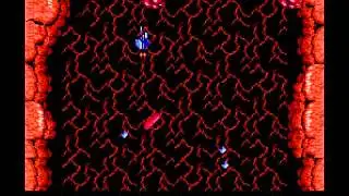 (NES) Life Force - 1 hit death central