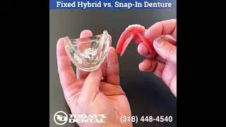 Permanent Dentures vs Snap-in Dentures - The Difference explained by Dr. Jonas Gauthier
