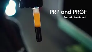 Platelet-Rich Plasma (PRP) and (PRGF) treatment for skin