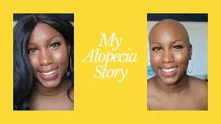 My Alopecia Story| How I Built Confidence Despite Hair loss