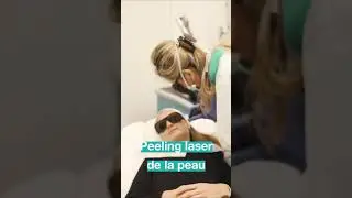 Peeling Laser