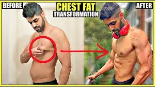 CHEST FAT TRANSFORMATION | My Before & After