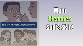 Mother Bleaches 9-Year-Old's Face To Keep Him Light!