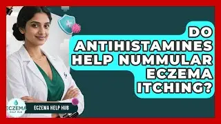 Do Antihistamines Help Nummular Eczema Itching? - Eczema Help Hub