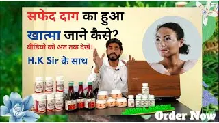 Safed daag ka Khatma  |Vitiligo |White spots |  Leucoderma  @arubaforestayurved #skincare