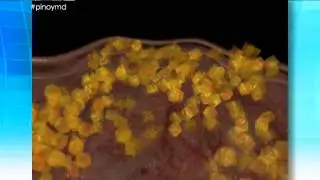 Bye, bye belly! | Pinoy MD