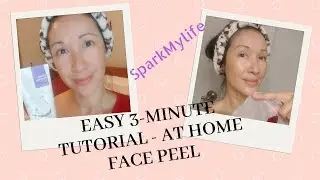 3 Minute Face Brightening Face Smart Peel (At Home) | Skincare Tips